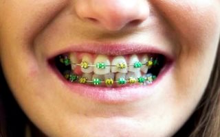 Orthodontic-Emergencies