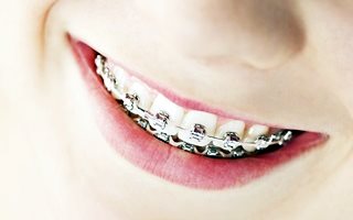 orthodontics2